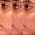 Vinopure Salicyl Serum image number null