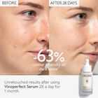 Vinoperfect Anti Dark Spot Radiance Serum Vitamin C Alternative  image number null