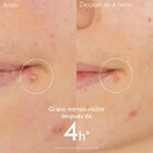 Vinopure Spot Solution image number null