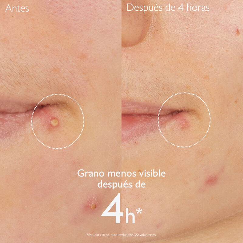 Vinopure Spot Solution image number null