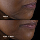 Lifting Face Neck Cream image number null