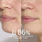 Vinopure Salicyl Serum image number null