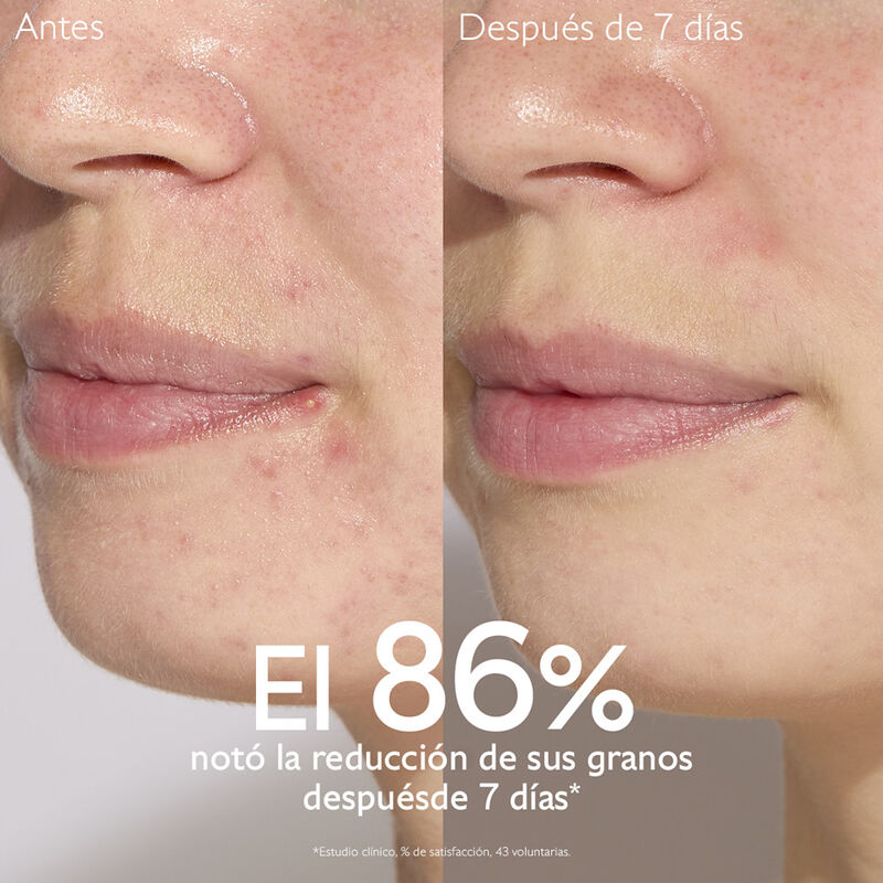 Vinopure Salicyl Serum image number null