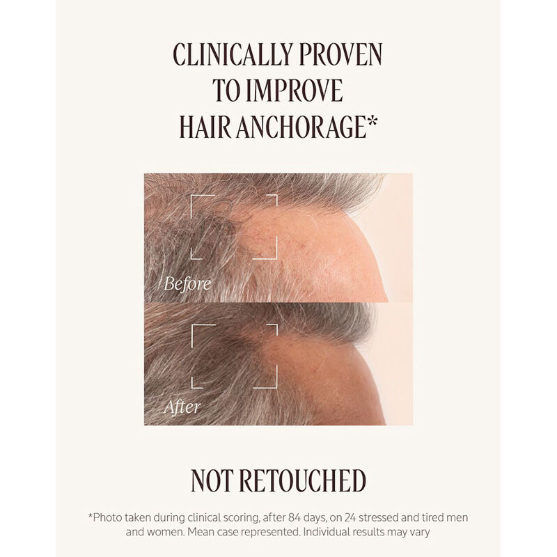 Hair Loss Treatment image number null