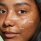 Vinopure Salicyl Serum image number null