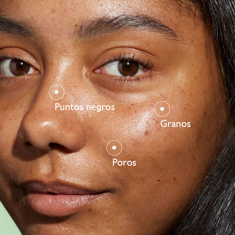 Vinopure Salicyl Serum image number null