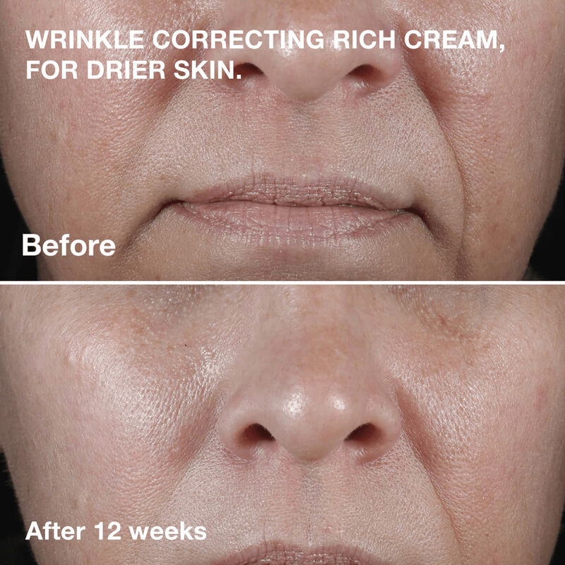 Clinique Smart Clinical Repair&trade; Wrinkle Correcting Cream image number null