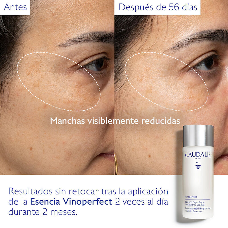 Vinoperfect Concentrated Brightening Glycolic Essence  image number null
