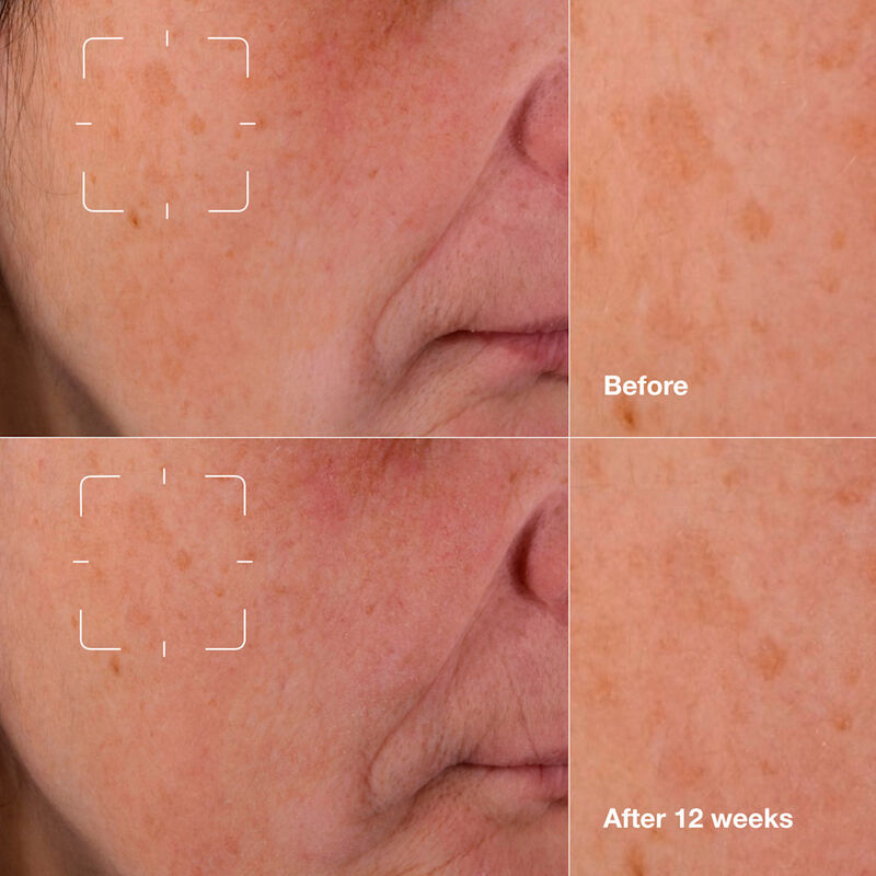 Even Better Clinical&trade Dark Spot Clearing Serum image number null