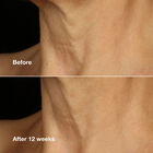Lifting Face Neck Cream image number null