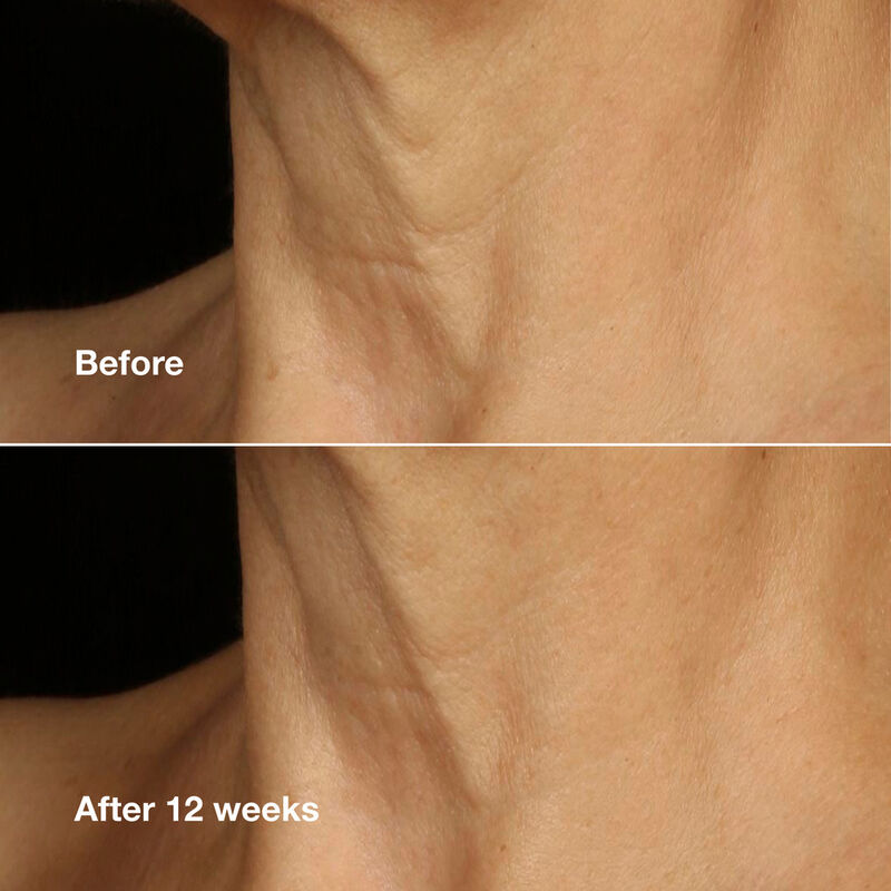 Lifting Face Neck Cream image number null