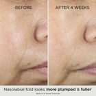 Prevage&reg Multi-Restorative Soft Cream image number null