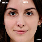 The Porefessional Foundation image number null