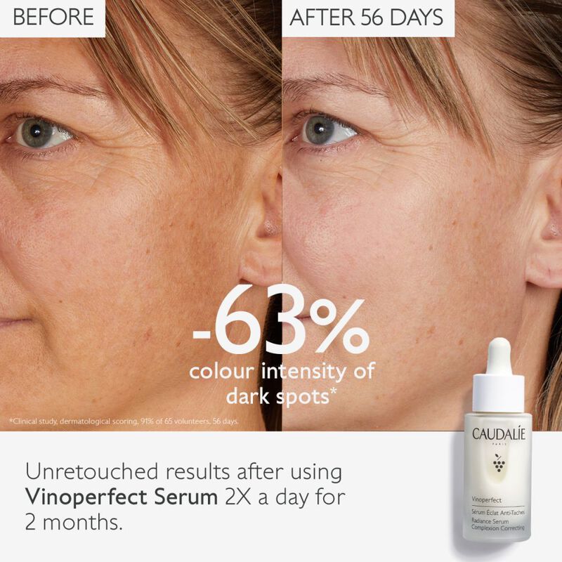 Vinoperfect Anti Dark Spot Radiance Serum Vitamin C Alternative  image number null