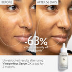 Vinoperfect Anti Dark Spot Radiance Serum Vitamin C Alternative  image number null